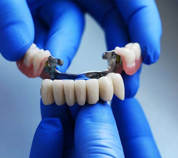 Glendale Dental Bridges