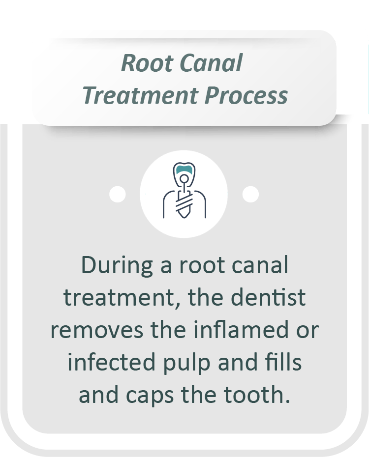 Root canal treatment infographic: During a root canal treatment, the dentist removes the inflamed or infected pulp and fills and caps the tooth.